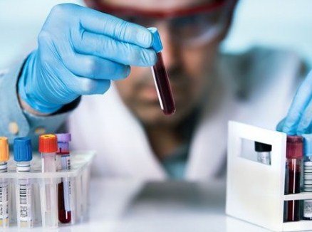 Как правильно сдавать анализы крови